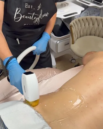Lézeres szőrtelenítés a háton a Beautyflow szalonban, szakember a kézidarabbal