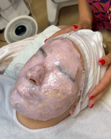 Alginát maszk az arcon kozmetikai kezelés közben